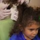 girl receiving airalle head lice treatment