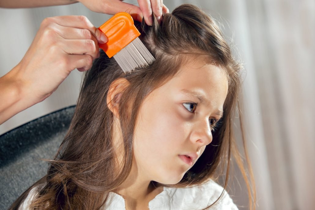 How to Get Rid of Lice Fast | Fresh Heads Lice Removal