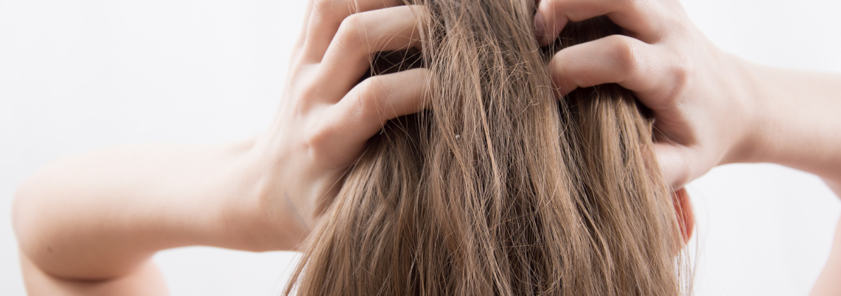 Itchy Scalp but No Lice? Here's What It Might Be