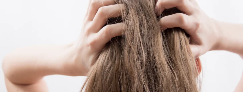 Itchy Scalp but No Lice? Here's What It Might Be