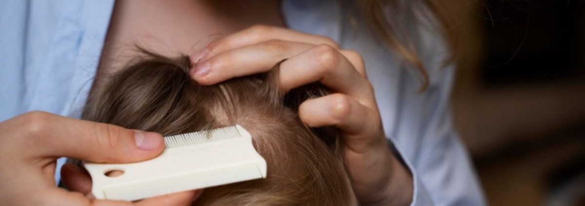 What are the Main Differences Between Head Lice and Body Lice?