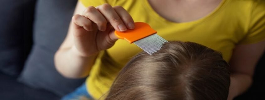 No-Panic Guide To Head Lice Treatment